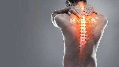 Lo que debes saber para cuidar tu espalda