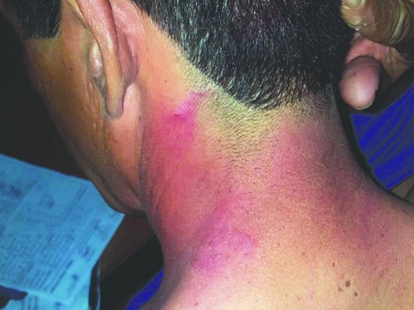 Duro relato del árbitro agredido en Yaguarón
