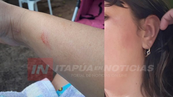 MUJER DENUNCIA RÁPIDA LIBERACIÓN DE SU PAREJA TRAS AGREDIRLA