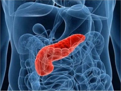 Inteligencia artificial para afinar qué quistes serán cáncer de páncreas