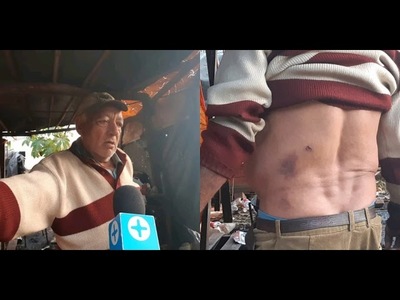 HUMILDE TRABAJADOR FUE ATACADO POR ADICTOS