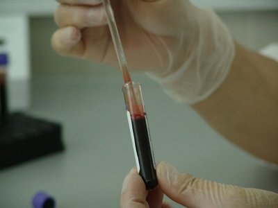 Latinoamérica debe mejorar acceso a terapias para VIH
