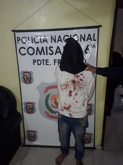 Joven adicto atacó a machetazos a sus padres
