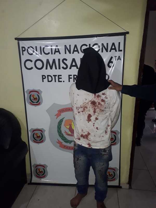 Joven adicto atacó a machetazos a sus padres