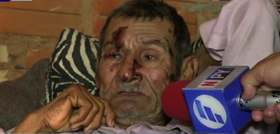 Atropelló a abuelito y se dio a la fuga | Noticias Paraguay