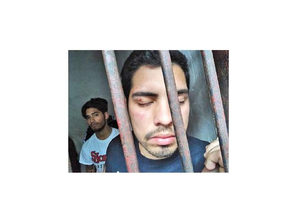 Comisario fue identificado como agresor de jóvenes en Lambaré