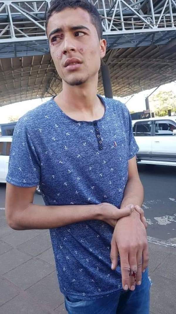 Efectivo de la Armada Nacional ataca con balines de goma a presunto guía turístico