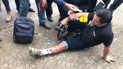 Reportero del Grupo Nación fue herido con balines de goma