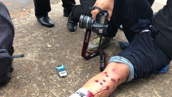 Heridos por balines de goma tras enfrentamiento entre Taxistas y la Policía » Ñanduti