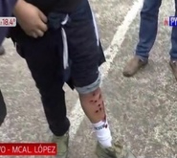 Varios periodistas agredidos y heridos en medio de manifestación - Paraguay.com