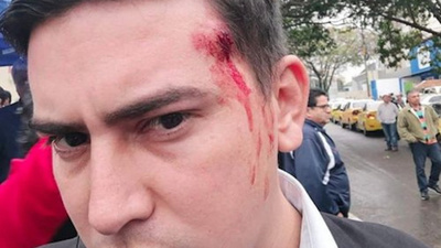El balín no alcanzó el ojo, aclaró