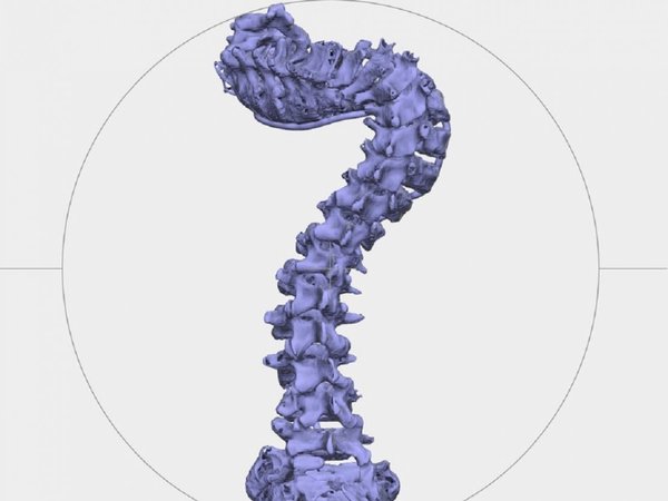 Crean sistema que proyecta tejidos 3D para atender enfermedades