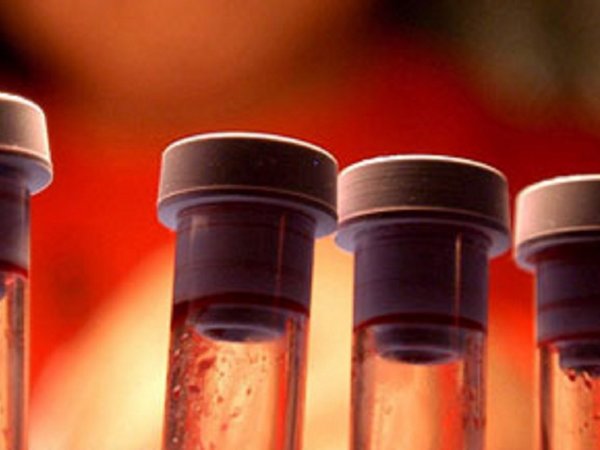 Nuevas herramientas para prevenir el VIH: Un implante y una vacuna