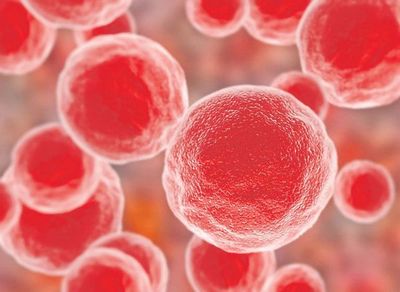 FDA suspende venta de implantes de pecho - Internacionales - ABC Color