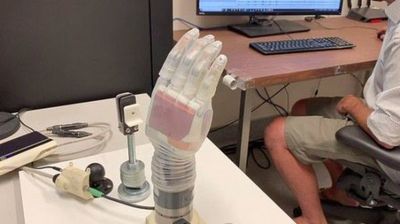 El “brazo Luke”, una prótesis capaz de agarrar un huevo sin romperlo - Tecnología - ABC Color