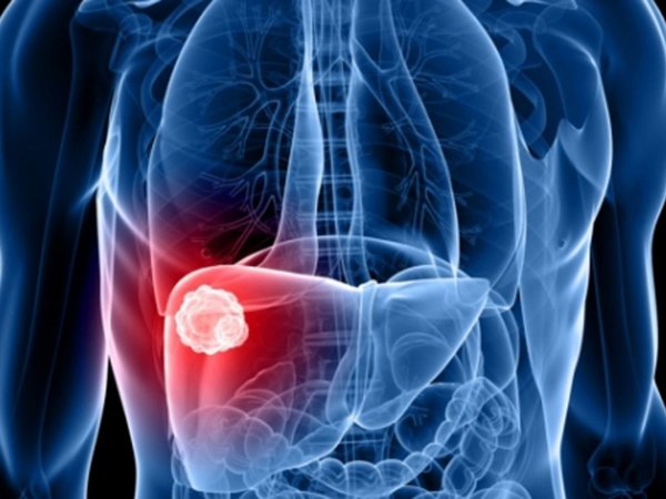 Un 80% de enfermos de hepatitis no tienen acceso a tratamiento