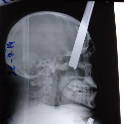 San Pedro: gresca deja a un hombre gravemente herido