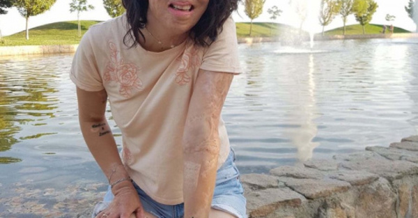 Venció el qué dirán y ahora motiva a todos