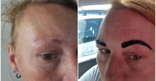 Le dejaron las cejas como “Angry Birds”