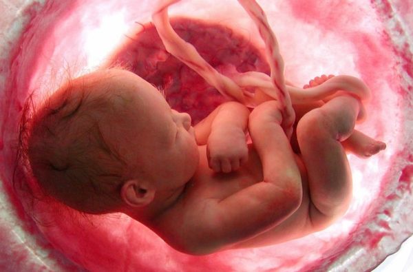 Charla sobre el aborto será hoy - ADN Paraguayo