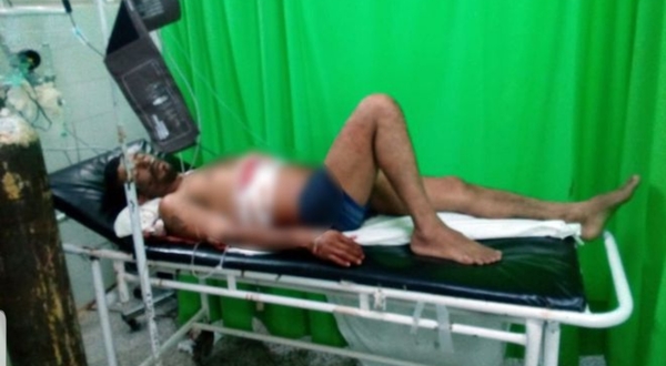 Yby Yaú: Hombre es atacado por sicarios y sobrevive