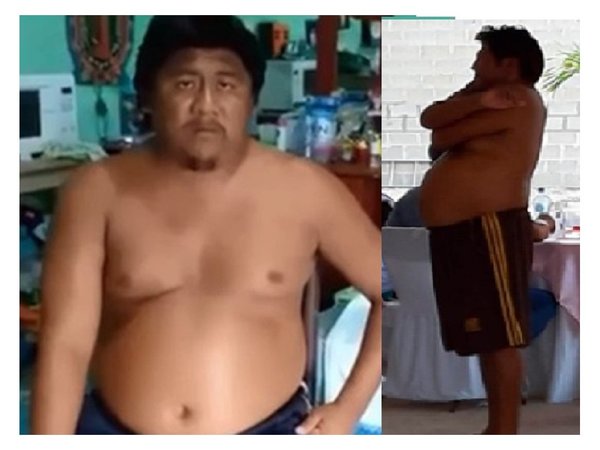 El hombre del meme sufre esquizofrenia