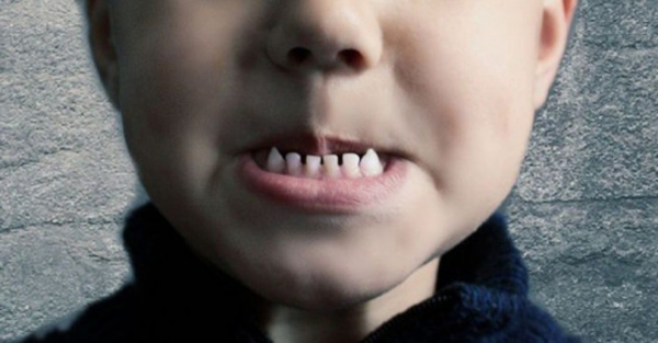 Extraen más  de 500 dientes  a un niño
