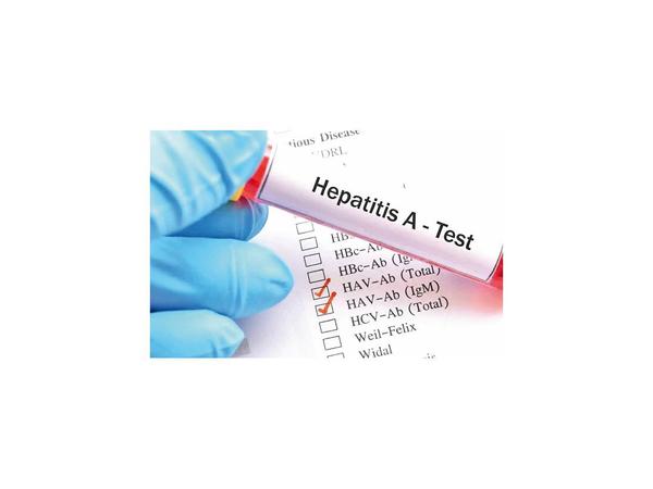 Florida, en estado de emergencia por un brote de hepatitis