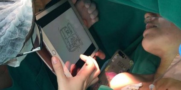 ADAPTAN AL GUARANÍ TÉCNICA APLICADA EN CIRUGÍA CON PACIENTES DESPIERTOS