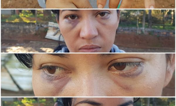 Mujer denunció ser agredida por sobrina de su ex pareja