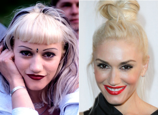 El antes y el después de tus artistas favoritos