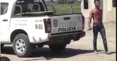 Viralizan video de joven que se  ¡cortó el pecho!
