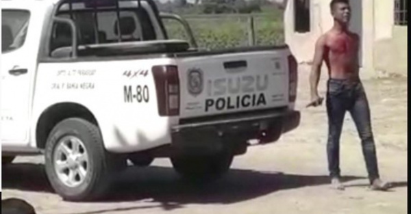 Viralizan video de joven que se  ¡cortó el pecho!