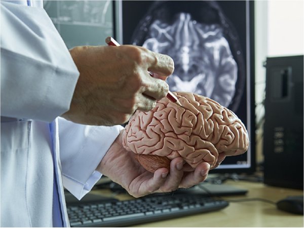 Científicos mexicanos desarrollan método de biopsia cerebral menos invasivo