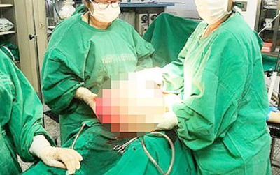 Mujer dio a luz  a un bebe’i y dos quistes feroces