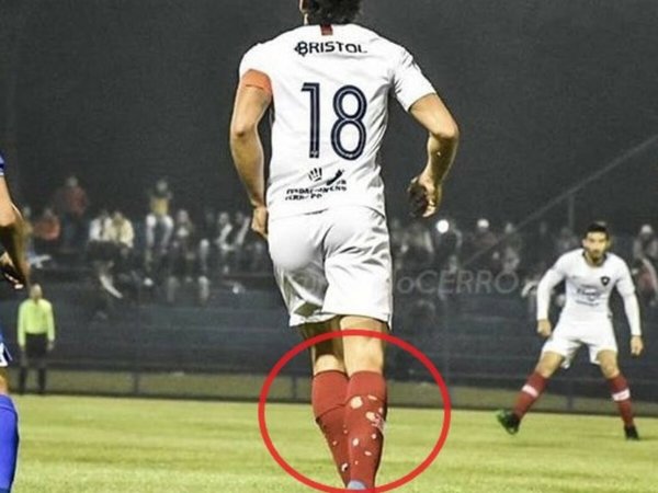 ¿Por qué Haedo jugó con las medias rotas?