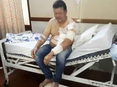 Papá héroe arriesgó su vida para salvar a hijas - Interior - ABC Color