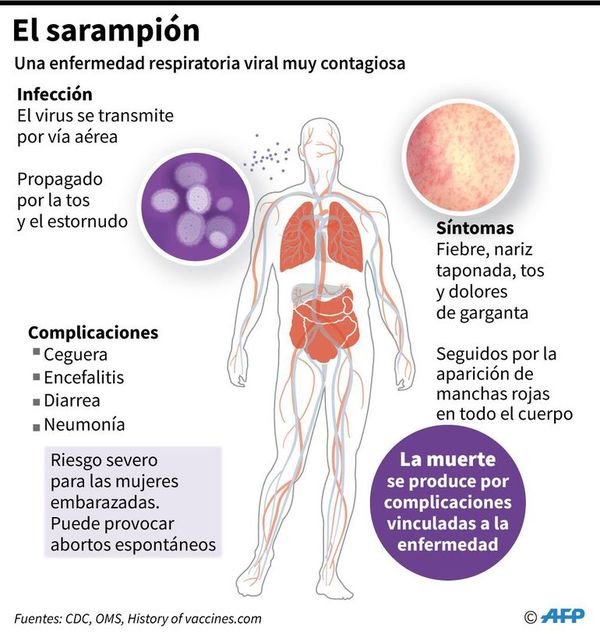 Desde enero se triplicaron los casos de sarampión en el mundo - Mundo - ABC Color