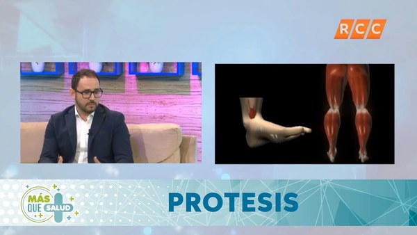 Mas que Salud | Prótesis | RCC 2019