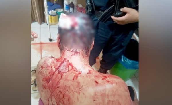 Dueños de despensa son brutalmente agredidos