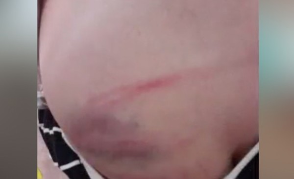 Rescatan a menor brutalmente agredida por su madre