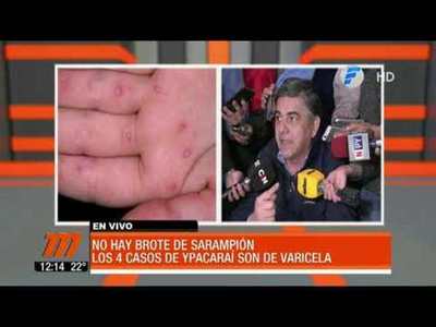 Desmienten brote de sarampión en Paraguay