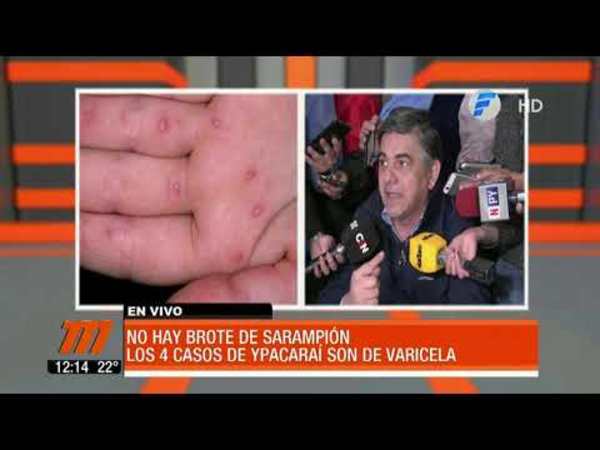 Desmienten brote de sarampión en Paraguay