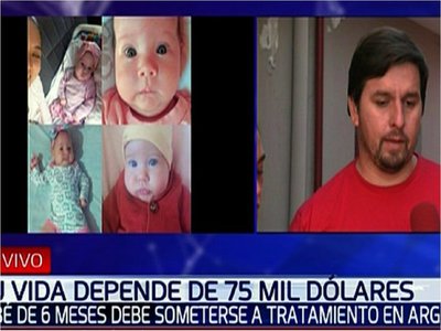 Beba necesita USD 75.000 para tratar enfermedad poco común