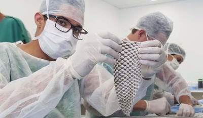 Realizan el primer implante de vagina con piel de pescado en Colombia - ADN Paraguayo