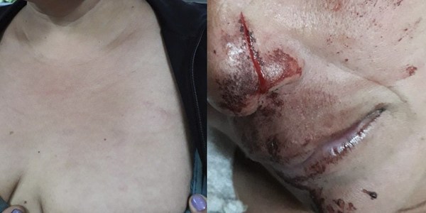 GRAL. DELGADO: HABRÍA MACHETEADO A SUS VECINAS Y TERMINÓ EN LA COMISARÍA