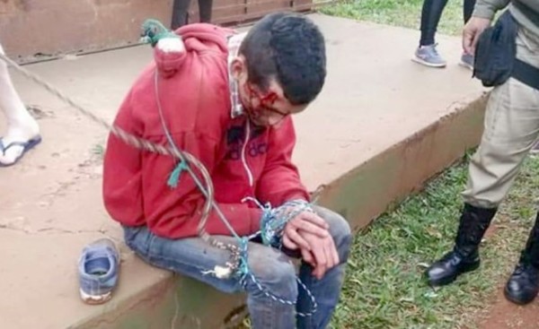 Motochorro detenido tras ser linchado por vecinos