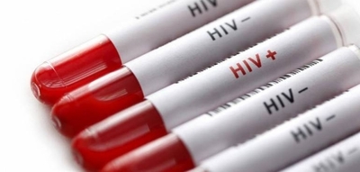 HOY / Tratamiento de profilaxis pre-exposición al VIH estaría disponible desde octubre