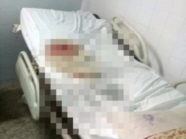 Pacientes de hospital tuvieron que pasar la noche con dos finados