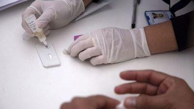 Hallan una segunda mutación genética resistente al virus del sida - .::RADIO NACIONAL::.